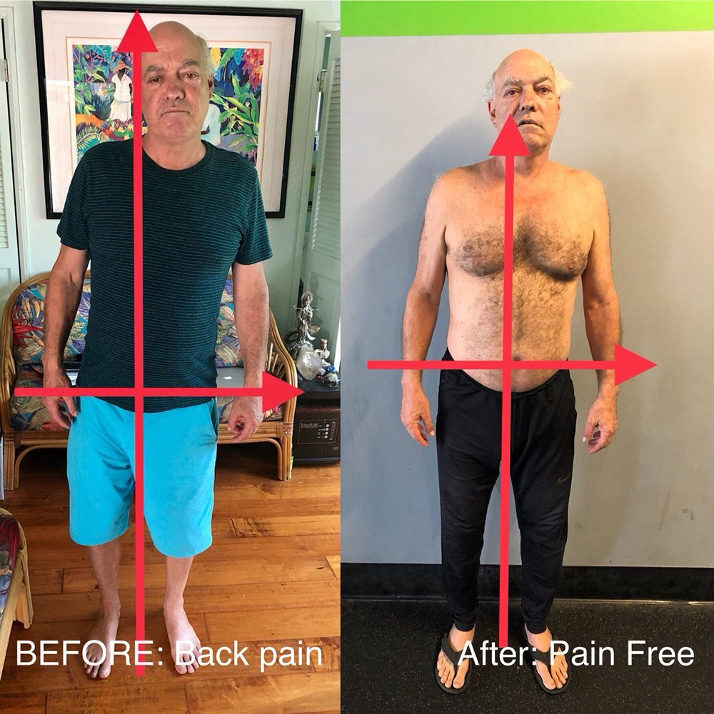 Client before and after — back pain to pain free